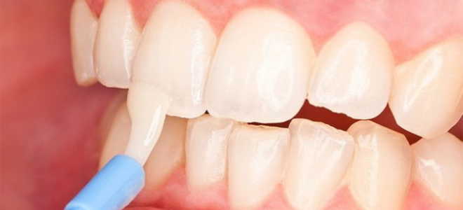 Зубная эмаль восстановление