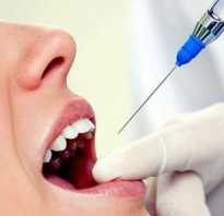 Вырвать зуб без боли