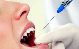Вырвать зуб без боли