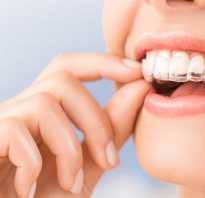 Как выровнять зубы без брекетов у взрослых