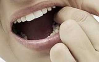 Могут ли от нервов болеть зубы