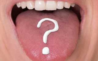 Заболевания полости рта у взрослых
