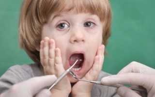 Методы лечения пульпита у детей
