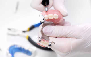Материалы для протезирования зубов