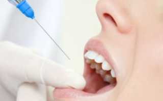 Сколько действует зубная анестезия