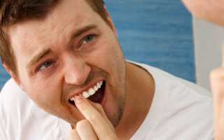 Шатание зубов причина лечение